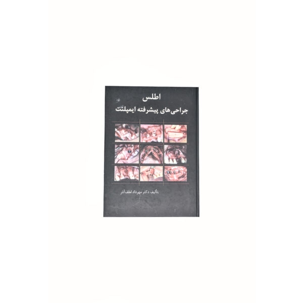 کتاب اطلس جراحی های پیشرفته ایمپلنت